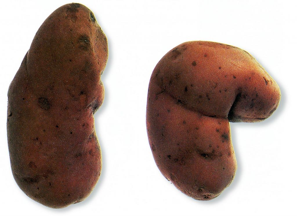 Aardappel (Désirée)